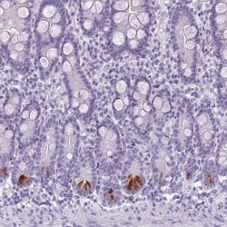TMEM91 Antibody, Novus Biologicals:Antibodies:Primary Antibodies